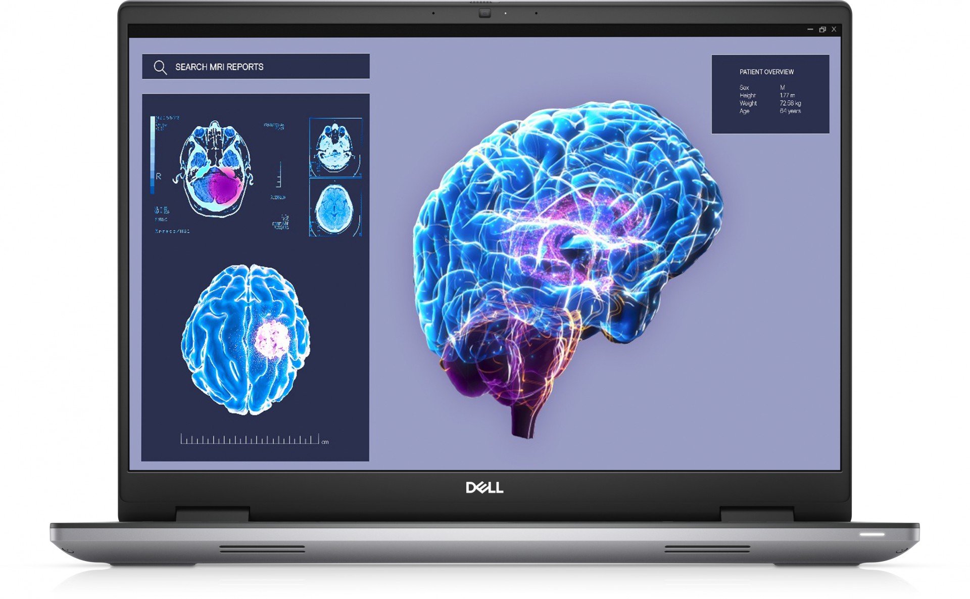 dell DELL Precision 7680 i7-13850HX Stație de lucru mobilă 40,6 cm (16') Full HD+ Intel® Core™ i7 16 Giga Bites DDR5-SDRAM 512 Giga Bites SSD NVIDIA RTX 2000 Wi-Fi 6E (802.11ax) Windows 11 Pro Gri (N010P7680EMEA_VP) dell DELL Precision 7680 i7-13850HX Stație de lucru mobilă 40,6 cm (16') Full HD+ Intel® Core™ i7 16 Giga Bites DDR5-SDRAM 512 Giga Bites SSD NVIDIA RTX 2000 Wi-Fi 6E (802.11ax) Windows 11 Pro Gri (N010P7680EMEA_VP)