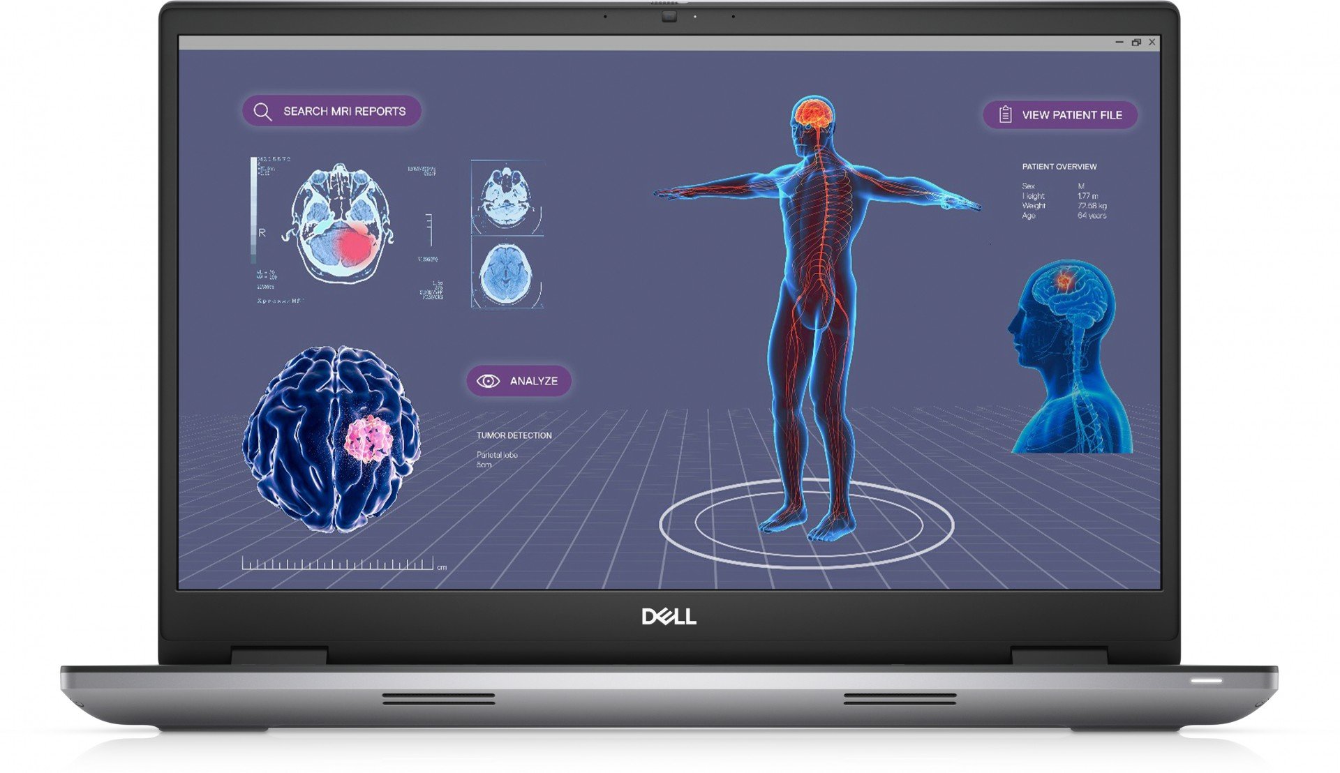 dell DELL Precision 7780 i7-13850HX Stație de lucru mobilă 43,9 cm (17.3') Full HD Intel® Core™ i7 16 Giga Bites DDR5-SDRAM 512 Giga Bites SSD NVIDIA RTX 2000 Wi-Fi 6E (802.11ax) Windows 11 Pro Gri (N009P7780EMEA_VP) dell DELL Precision 7780 i7-13850HX Stație de lucru mobilă 43,9 cm (17.3') Full HD Intel® Core™ i7 16 Giga Bites DDR5-SDRAM 512 Giga Bites SSD NVIDIA RTX 2000 Wi-Fi 6E (802.11ax) Windows 11 Pro Gri (N009P7780EMEA_VP)