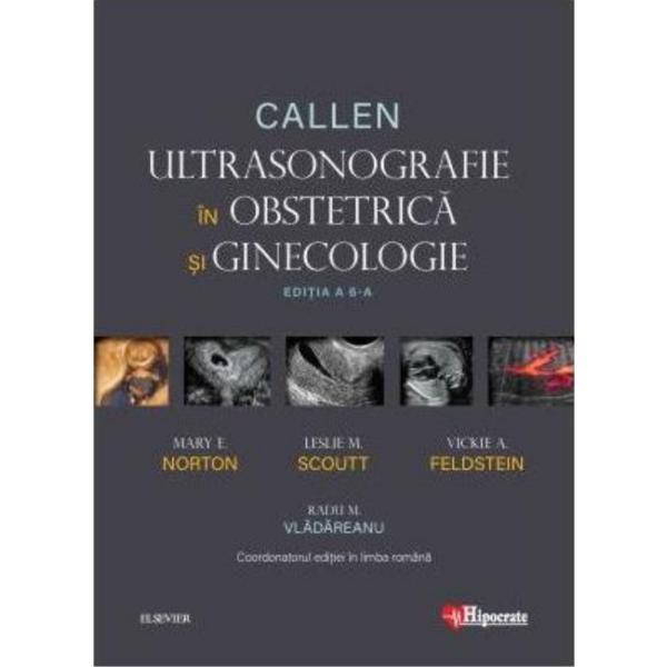 Callen. Ultrasonografie in Obstretica si Ginecologie - Mary E. Norton, Leslie M. Scoutt, Vickie A. Feldstein, editura Hipocrate Callen. Ultrasonografie in Obstretica si Ginecologie - Mary E. Norton, Leslie M. Scoutt, Vickie A. Feldstein, editura Hipocrate