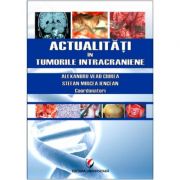 Actualitati in tumorile intracraniene - Prof. Dr. MSc. Alexandru Vlad Ciurea Actualitati in tumorile intracraniene - Prof. Dr. MSc. Alexandru Vlad Ciurea