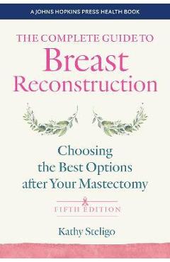 The Complete Guide to Breast Reconstruction: Choosing the Best Options After Your Mastectomy - Kathy Steligo The Complete Guide to Breast Reconstruction: Choosing the Best Options After Your Mastectomy - Kathy Steligo