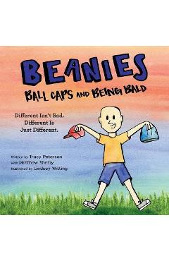 Beanies, Ball Caps, and Being Bald: Different Isn't Bad, Different Is Just Different - Tracy Peterson Beanies, Ball Caps, and Being Bald: Different Isn't Bad, Different Is Just Different - Tracy Peterson