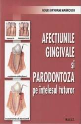 Afectiunile gingivale si paradontoza pe intelesul tuturor - Nouri Davijani Mahnoush