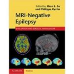 MRI-Negative Epilepsy: Evaluation and Surgical Management - Elson L. So, Philippe Ryvlin