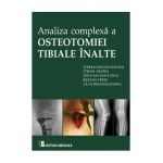Analiza complexa a Osteotomiei Tibiale Inalte - Serban Dragosloveanu