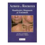Acneea si rozaceea - David J. Goldberg