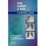 Chest X-Ray: A Survival Guide - Gerald De Lacey