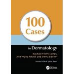 100 Cases in Dermatology | Rachael Morris-Jones