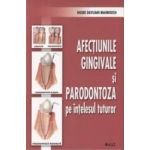 Afectiunile gingivale si paradontoza pe intelesul tuturor - Nouri Davijani Mahnoush