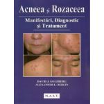 Acneea si rozaceea | David J. Goldberg, Alexander L. Berlin