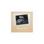 Pearhead - Rama foto , Pentru ecografie