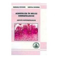 Acantoliza in bolile dermatologice - Mariana Costache, Daniela Ciochina