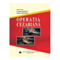 Operatia cezariana - Cringu Ionescu, Mihai Dimitriu