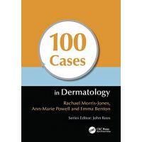 100 Cases in Dermatology | Rachael Morris-Jones