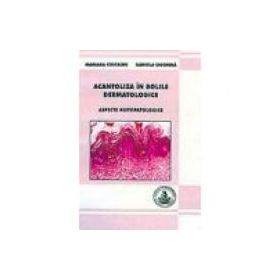 Acantoliza in bolile dermatologice - Mariana Costache, Daniela Ciochina
