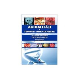 Actualitati in tumorile intracraniene - Prof. Dr. MSc. Alexandru Vlad Ciurea