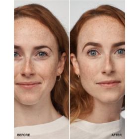 Clinique Even Better Clinical Serum Foundation SPF 20 machiaj de îngrijire SPF 20