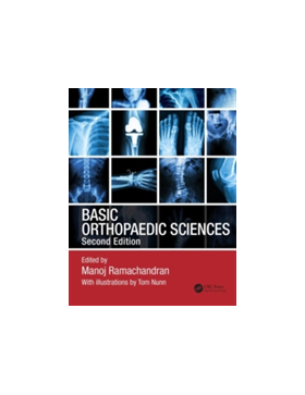 Basic Orthopaedic Sciences, Second Edition | 