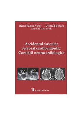 Accidentul vascular cerebral cardioembolic. Corelatii Neurocardiologice - Ileana Raluca Nistor