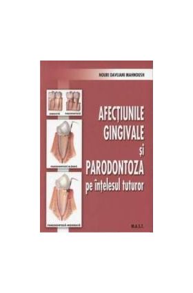 Afectiunile gingivale si paradontoza pe intelesul tuturor - Nouri Davijani Mahnoush