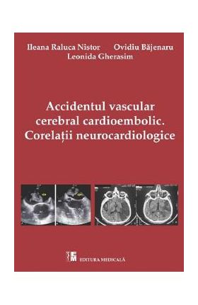 Accidentul vascular cerebral cardioembolic. Corelatii Neurocardiologice - Ileana Raluca Nistor