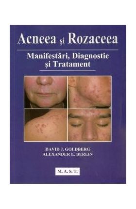 Acneea si rozaceea - David J. Goldberg