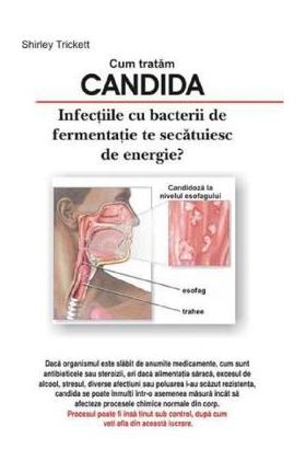 Cum tratam candida - Shitley Trickett