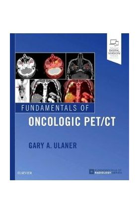 Fundamentals of Oncologic PET/CT - Gary Ulaner