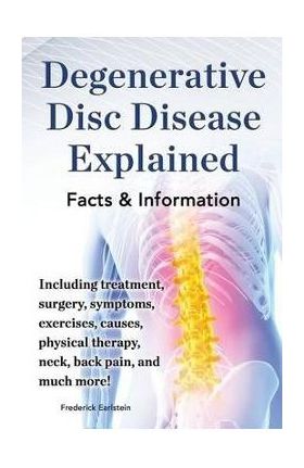 Degenerative Disc Disease Explained. Including Treatment, Surgery, Symptoms, Exercises, Causes, Physical Therapy, Neck, Back, Pain, and Much More! Fac - Frederick Earlstein