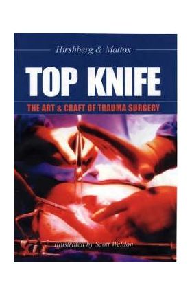 Top Knife