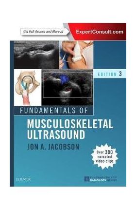 Fundamentals of Musculoskeletal Ultrasound