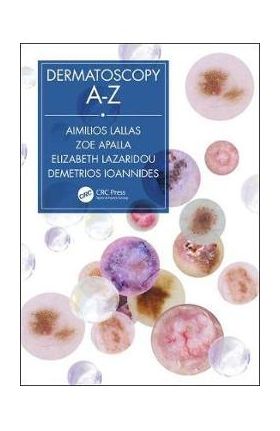 Dermatoscopy A-Z - Aimilios Lallas