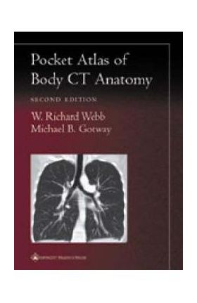 Pocket Atlas of Body CT Anatomy