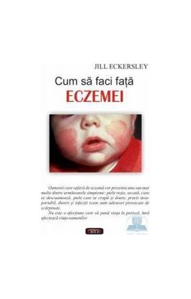 Cum sa faci fata eczemei - Jill Eckersley