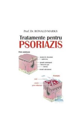 Tratamente pentru psoriazis - Ronald Marks